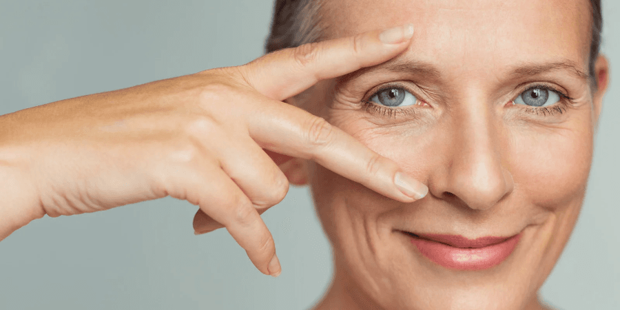 Risultato naturale Intervento di Blefaroplastica