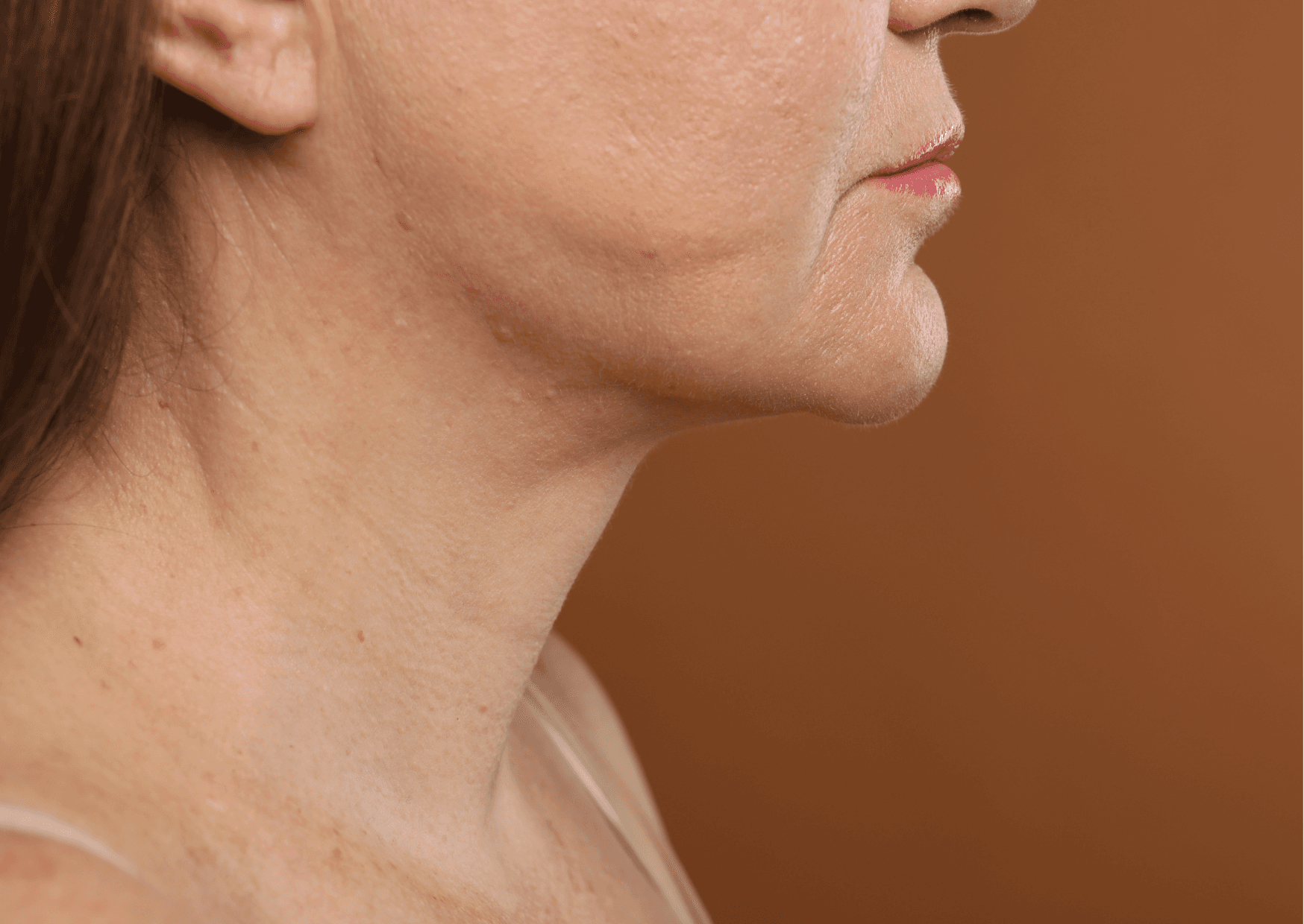 Facelift naturale: come ringiovanire il viso senza stravolgerlo