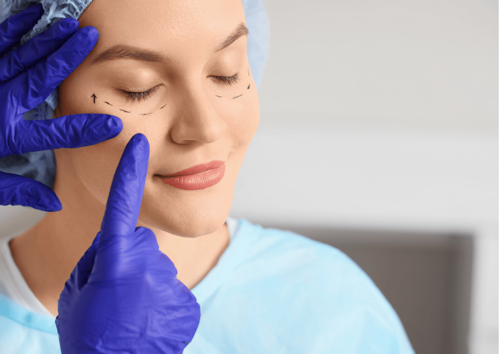 Facelift: Il segreto Antietà