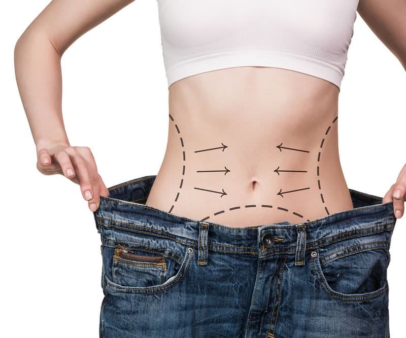 Reconstructive Plastic Surgery after Obesity